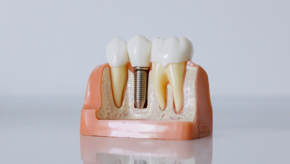 https://alphadentalcare.lk/wp-content/uploads/2024/11/3-1.jpg