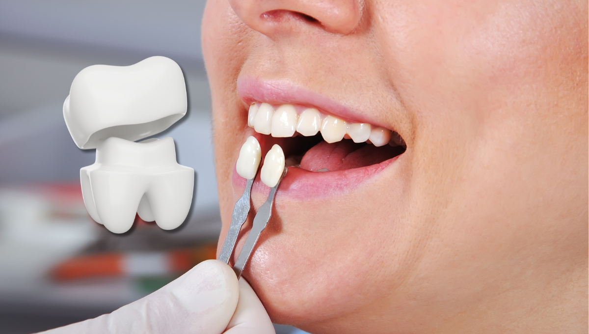 https://alphadentalcare.lk/wp-content/uploads/2024/12/5.png