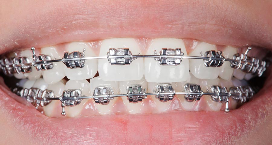 https://alphadentalcare.lk/wp-content/uploads/2024/12/ZA-Blog-053.jpg